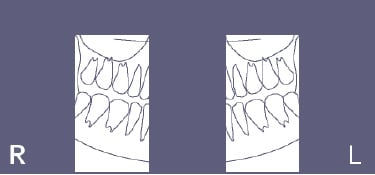 上部カットした前歯部から大臼歯部までの撮影