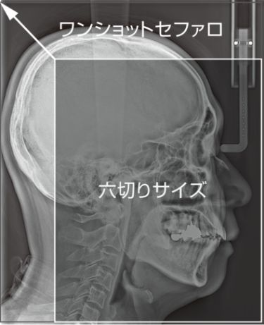 広い撮影領域