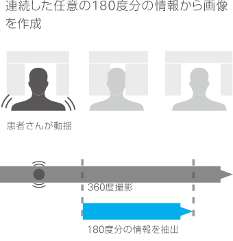 180度再構成のイメージ