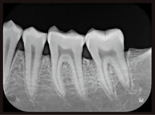Veraview iP