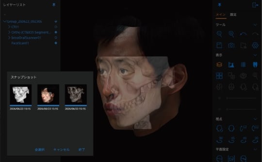 スナップショット