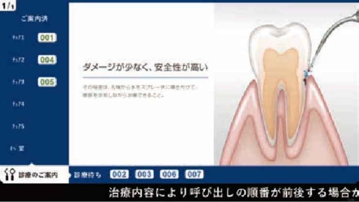 ディスプレイのサイドに案内状況を表示します