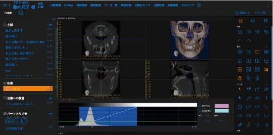 CT Viewer