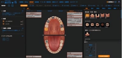 視診触診
