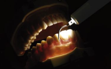 ハンドピース先端から照射される明るいLEDライトは、治療部位を見やすくしてより精密な治療をサポート