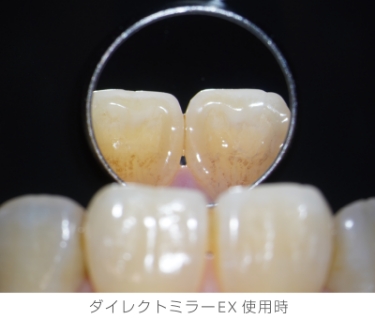 ダイレクトミラーEX使用時