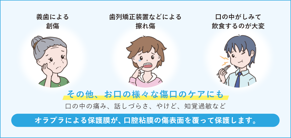 義歯による創傷／歯列矯正装置などによる擦れ傷／口の中がしみて飲食するのが大変　その他、お口の様々な傷口ケアにも