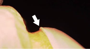 OPAQUEを内面全体に塗布、焼結後の良好な適合性