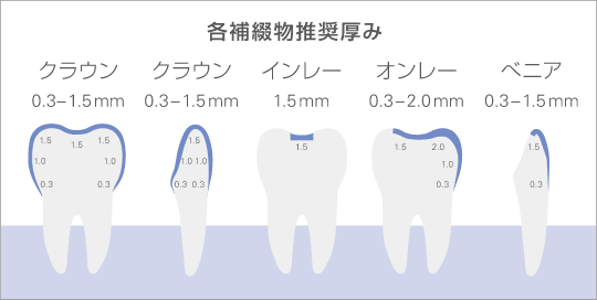 各補綴物推奨厚み