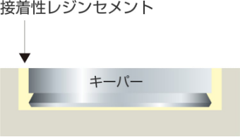 Step2