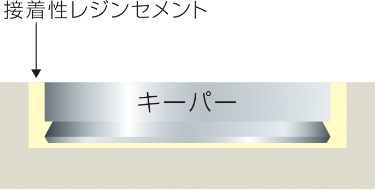 Step2