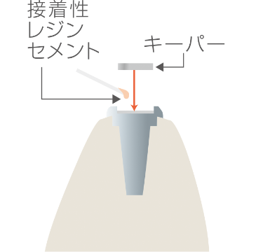 Step2