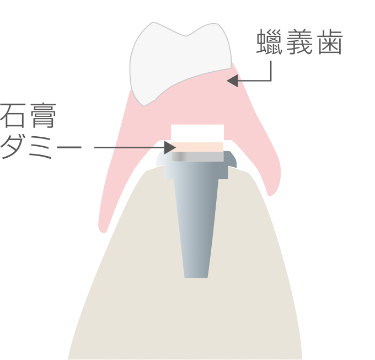 Step3