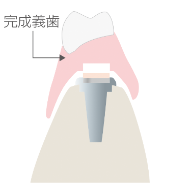 Step4