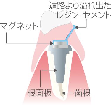 Step6