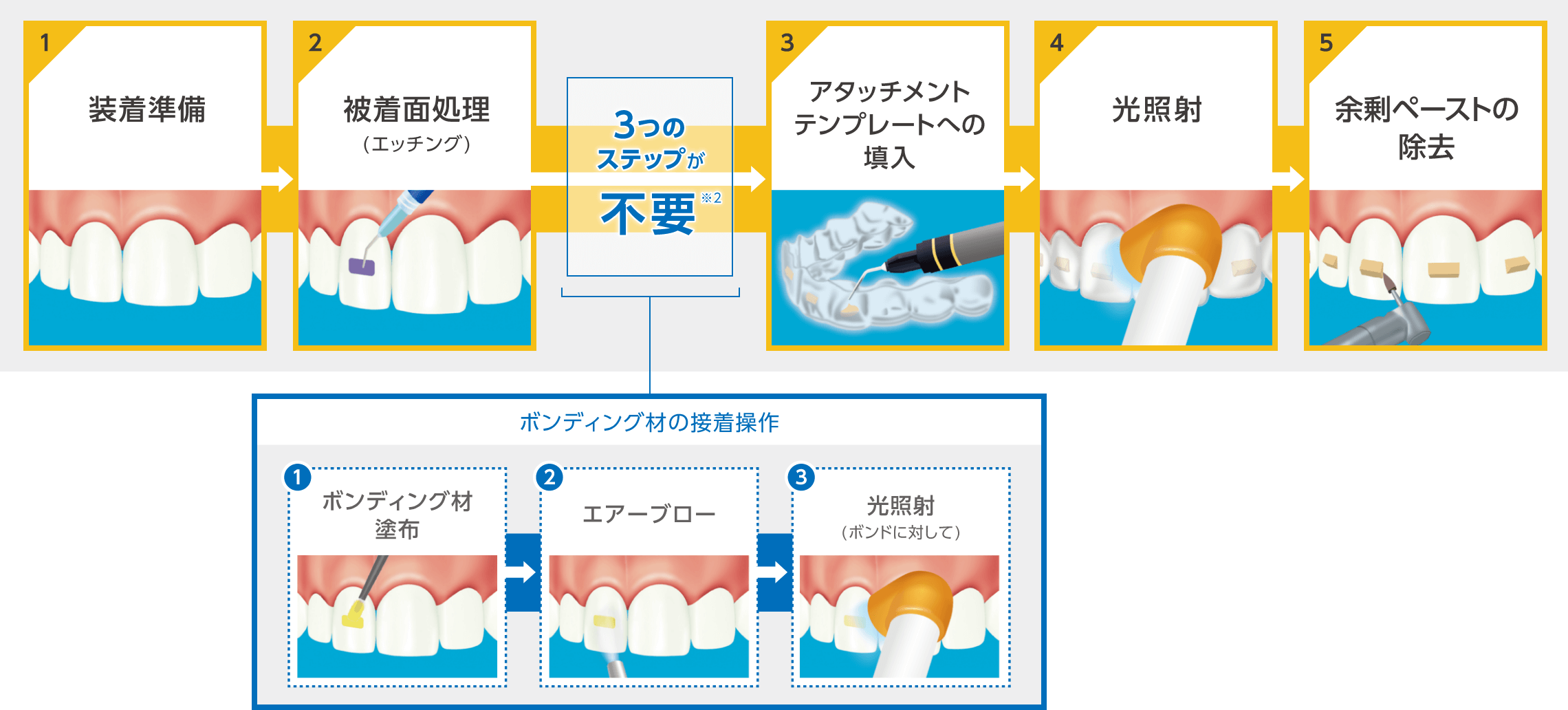 「SA アタッチメント for アライナー」の使用ステップ例