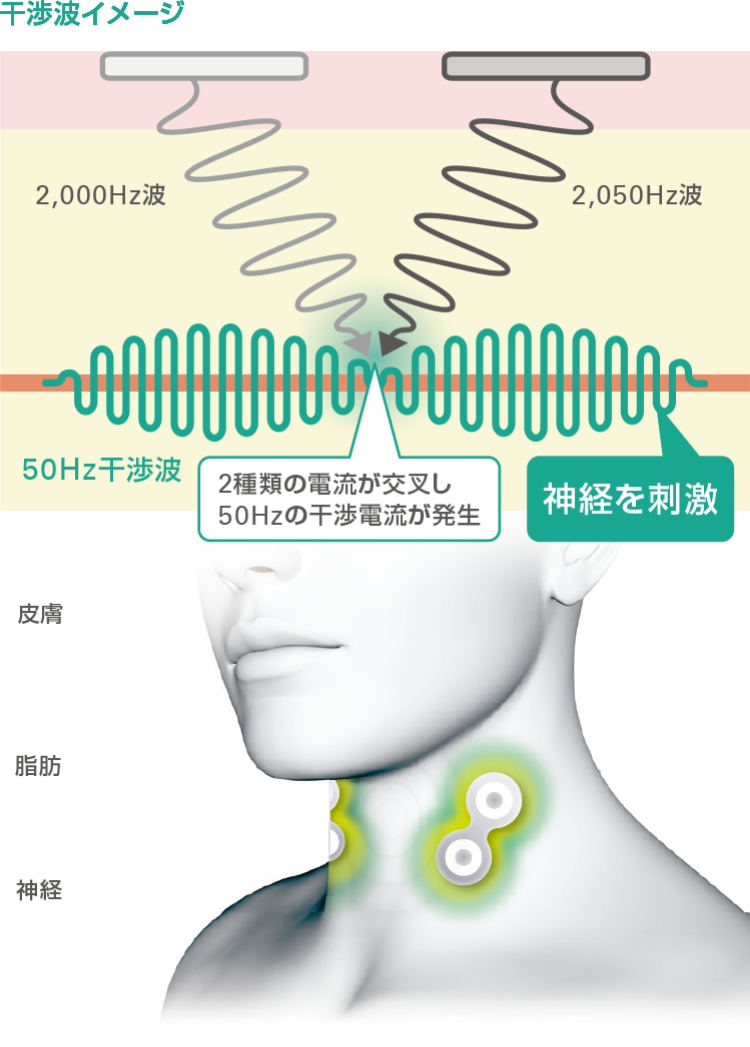 干渉波イメージ