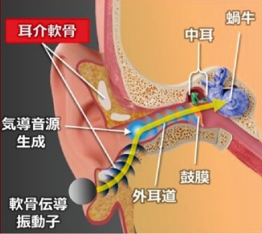 軟骨伝導経路
