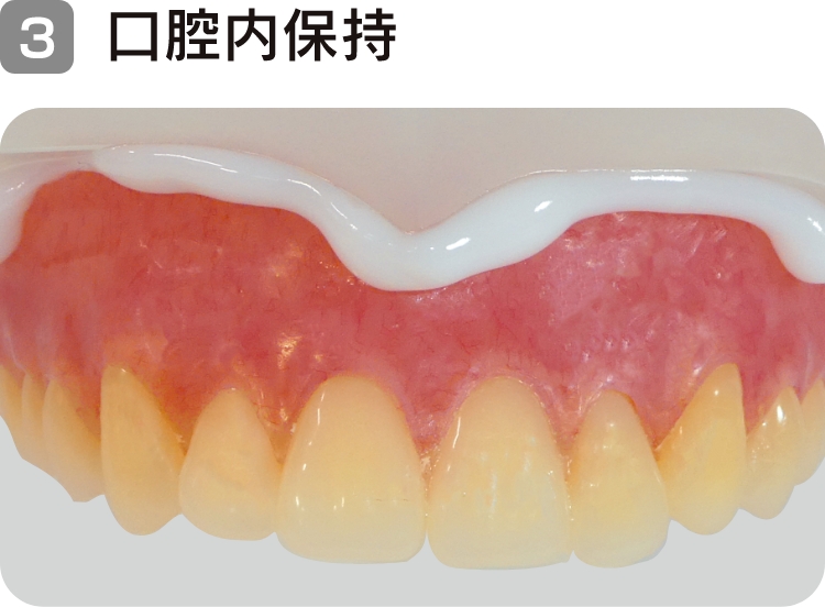 3. 口腔内保持