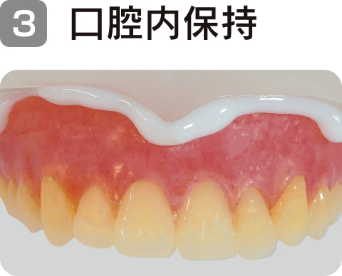 3. 口腔内保持