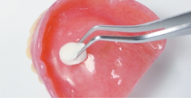 義歯床内面にフレクトンプライマーを一層薄く塗布します。