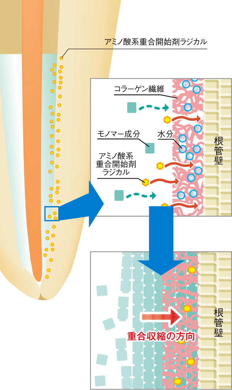 BPOフリーの独自のアミノ酸系重合開始剤を採用