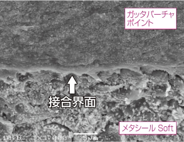 ガッタパーチャポイントと「メタシール Soft」の界面