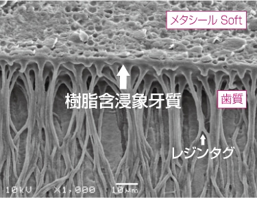 「メタシール Soft」と根管象牙質の界面