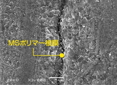 MSポリマー被膜でマイクロクラックを封鎖し、刺激の伝達を抑制する。