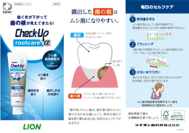 歯ぐきが下がって歯の根が見えてきた！Check-Up rootcare α