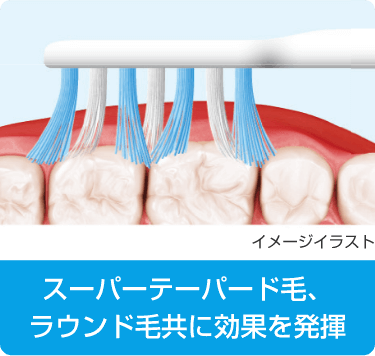 スーパーテーパード毛、ラウンド毛共に効果を発揮