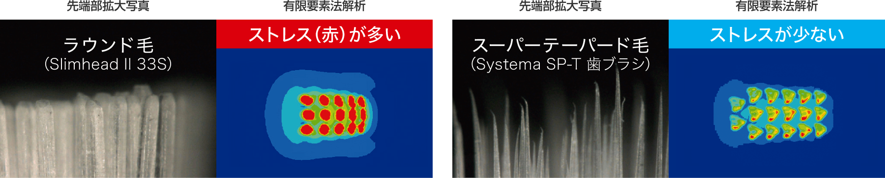 有限要素法による歯肉へのストレス解析