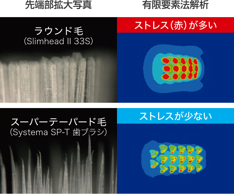 有限要素法による歯肉へのストレス解析
