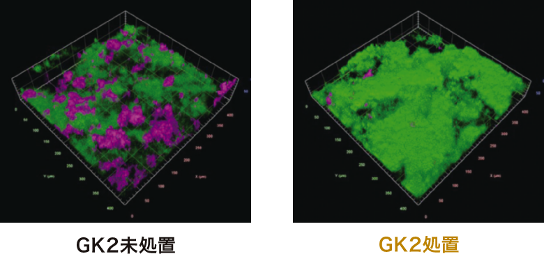 細菌叢中のP. gingivalisの分布
