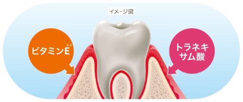 ホストケア（歯肉ケア）
