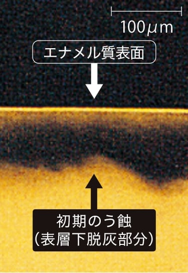 処置前