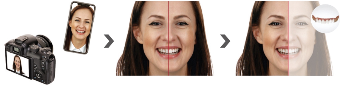 TRIOS Smile Design