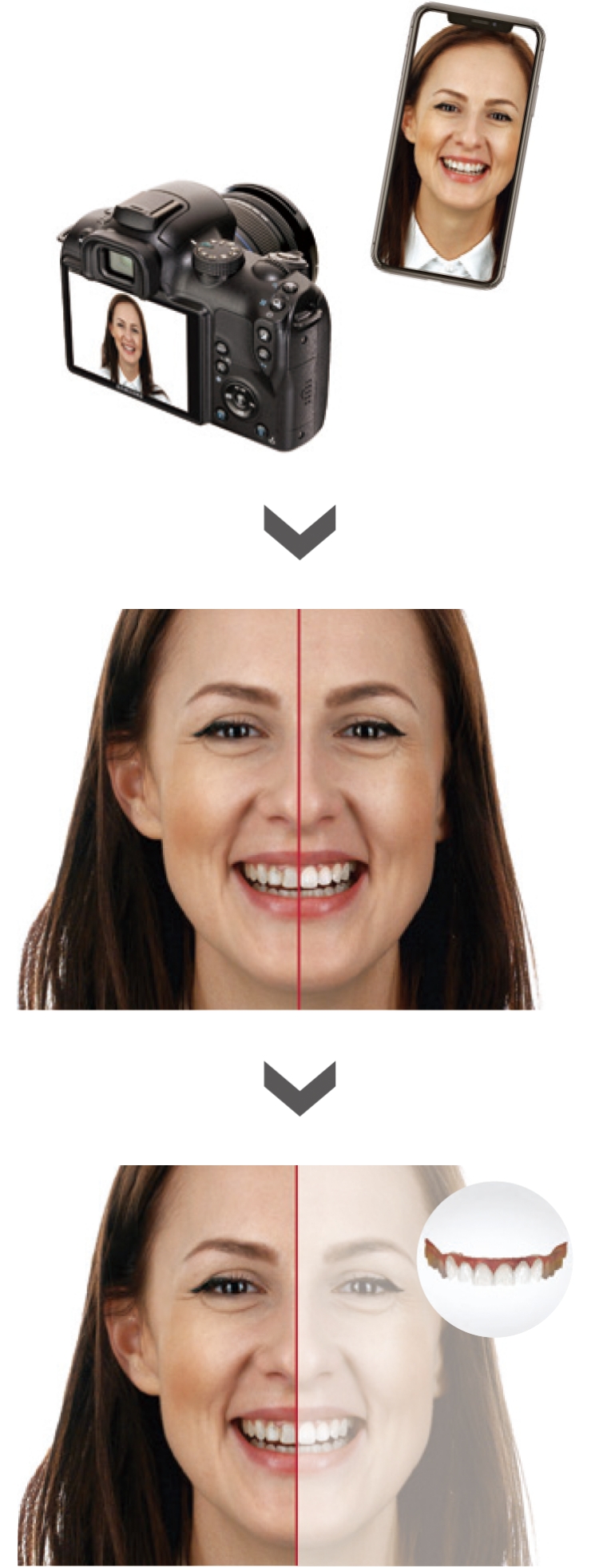 TRIOS Smile Design