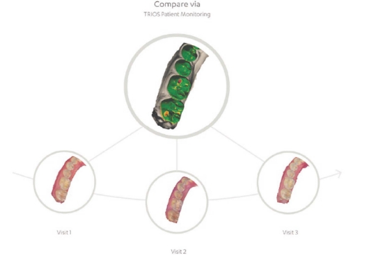 TRIOS Patient Monitoring