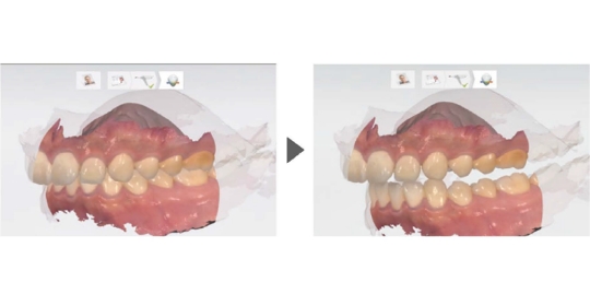 Patient Specific Motion