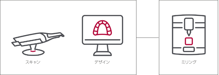 補綴物製作までの流れ