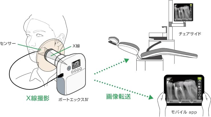 モニターですぐに確認可能の図解