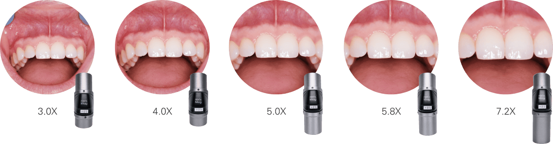 ルーペ倍率と視野のイメージ