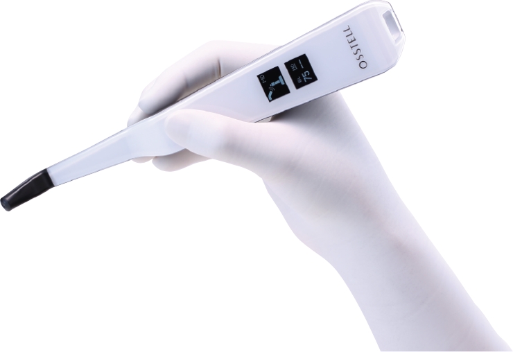 オステルビーコン