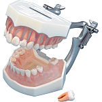 複製模型歯着脱顎模型 PE-ANA009（I21D-400C）｜オンラインカタログ