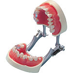 複製模型歯着脱顎模型 PE-ANA009（I21D-400C）｜オンラインカタログ