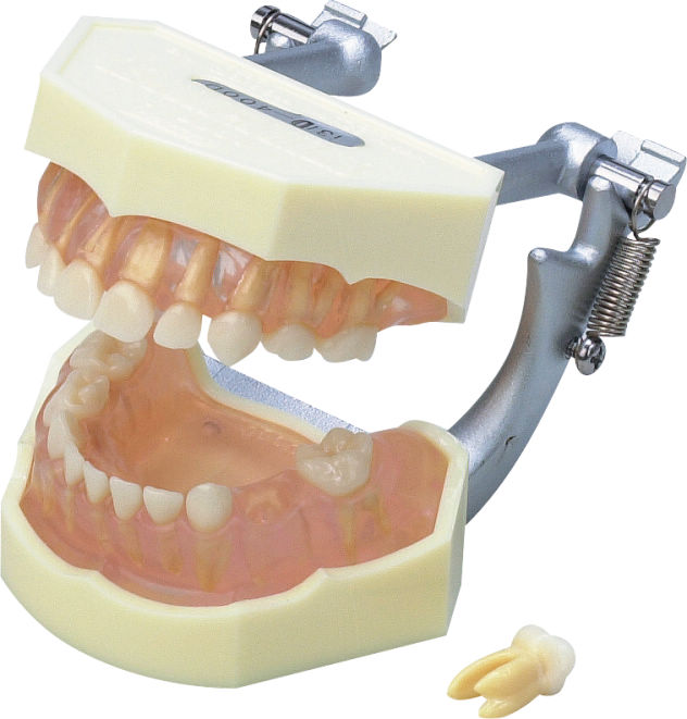 歯科 顎模型 - その他