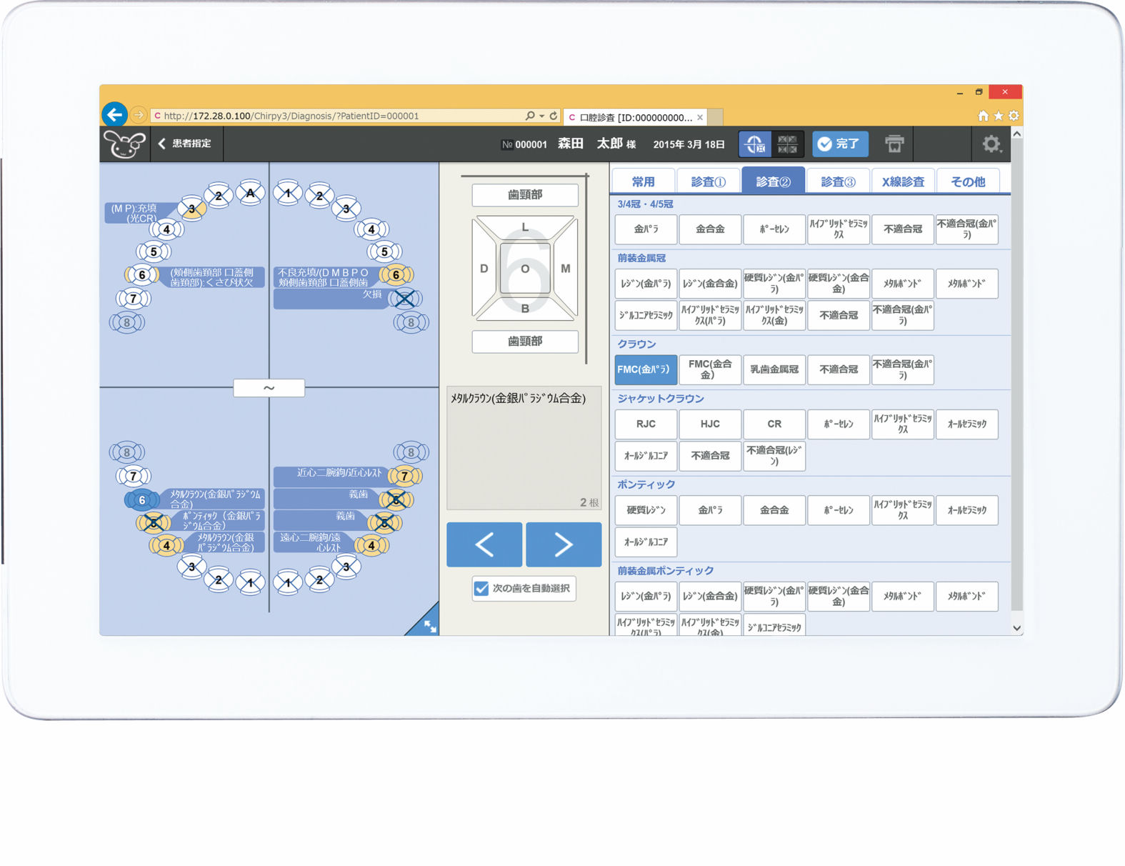 ChirpyⅢ（チャーピィⅢ）｜オンラインカタログ internet DO【株式会社