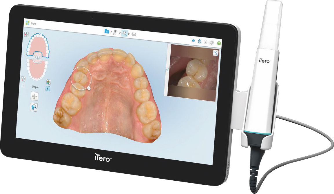 iTero Lumina モバイル 補綴・矯正｜オンラインカタログ internet DO