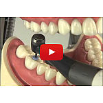 モリタ　トライオートmini モリタ】トライオートmini - コンパクトコードレスエンドドン